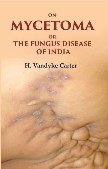 On Mycetoma or the Fungus Disease of India