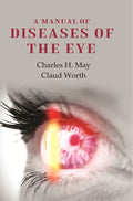 A Manual of Diseases of the Eye